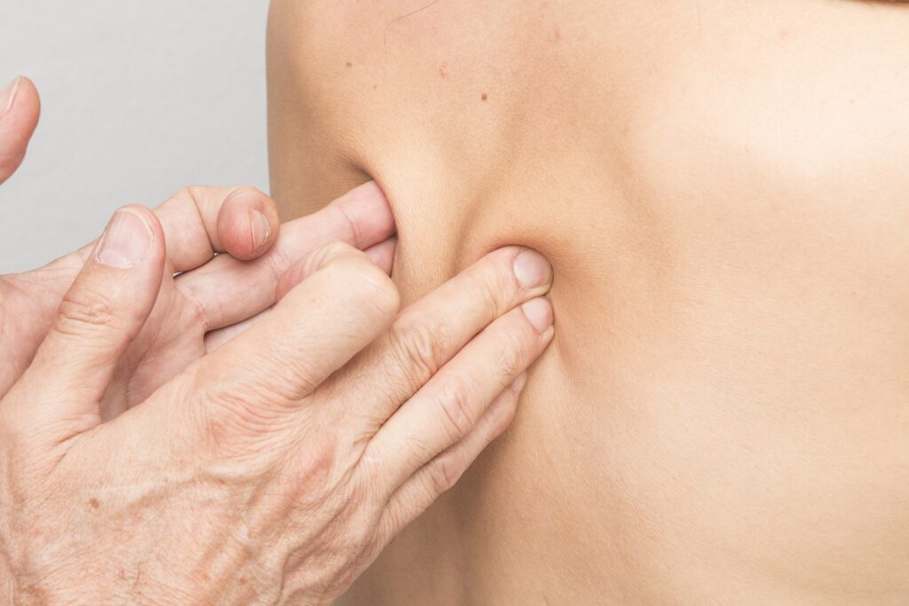 Terapia FDM w leczeniu urazów tkanek