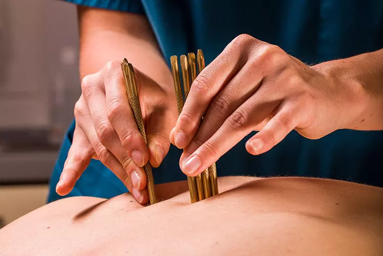 Terapia narzędziowa w leczeniu napięcia mięśniowego