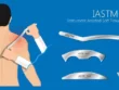 Terapia narzędziowa tkanek miękkich (IASTM) – precyzyjna praca z bliznami i zrostami
