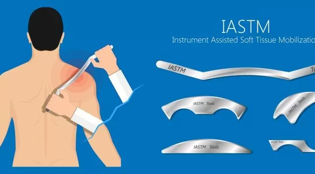 Terapia narzędziowa tkanek miękkich (IASTM) – precyzyjna praca z bliznami i zrostami