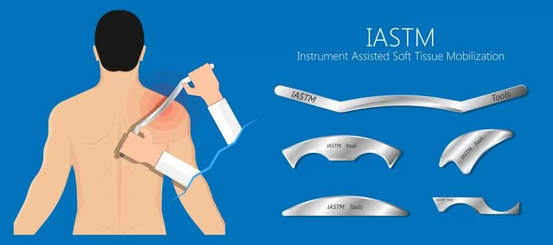 Terapia narzędziowa tkanek miękkich (IASTM) – precyzyjna praca z bliznami i zrostami